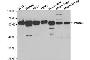 Western blot analysis of extracts of various cell lines, using RMDN3 antibody (ABIN5973434) at 1/1000 dilution. (RMDN3 Antikörper)