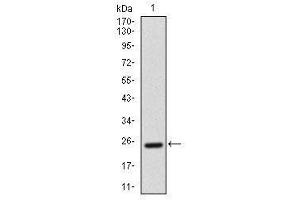 Image no. 2 for anti-Activated Leukocyte Cell Adhesion Molecule (ALCAM) antibody (ABIN1491488) (CD166 Antikörper)