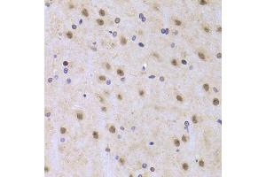 Immunohistochemistry of paraffin-embedded rat brain using ILF2 Antibody (ABIN5973487) at dilution of 1/100 (40x lens). (ILF2 Antikörper)