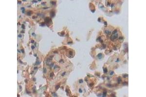 IHC-P analysis of Human Tissue, with DAB staining. (LOXL1 Antikörper  (AA 369-574))