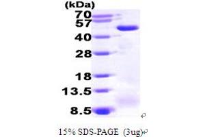 SDS-PAGE (SDS) image for Medium-Chain Specific Acyl-CoA Dehydrogenase, Mitochondrial (AA 26-421) protein (His tag) (ABIN667793)