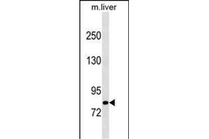Western Blotting (WB) image for anti-Cbl Proto-Oncogene B, E3 Ubiquitin Protein Ligase (CBLB) (AA 862-889), (C-Term) antibody (ABIN1537633)