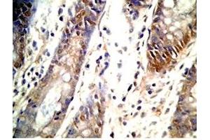 Human colon tissue was stained by Rabbit Anti-GLP-1 (2-24) (Human) Antibody (GLP-1 Antikörper  (AA 2-24))