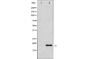 Western blot analysis of Synuclein expression in HuvEc whole cell lysates,The lane on the left is treated with the antigen-specific peptide. (SNCA Antikörper  (C-Term))