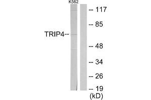 Western blot analysis of extracts from K562 cells, using TRIP4 antibody. (TRIP4 Antikörper  (Internal Region))