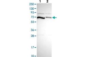 Western blot analysis of Lane 1: Human cell line RT-4 Lane 2: Human cell line U-251MG sp with PCK2 polyclonal antibody  at 1:250-1:500 dilution. (PEPCK Antikörper)