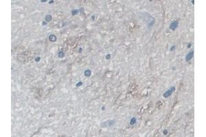 Immunohistochemistry (IHC) image for anti-Myosin ID (MYO1D) (AA 512-788) antibody (ABIN7437884)