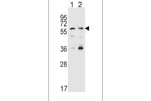 Western blot analysis in Hela(lane 1),K562(lane 2) cell line lysates (35ug/lane). (SLC22A4 Antikörper  (C-Term))