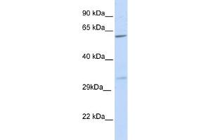 WB Suggested Anti-PRPS2 Antibody Titration:  0. (PRPS2 Antikörper  (N-Term))