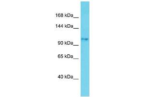 Host: Rabbit Target Name: SKIDA1 Sample Type: Jurkat Whole Cell lysates Antibody Dilution: 1. (SKIDA1 Antikörper  (C-Term))