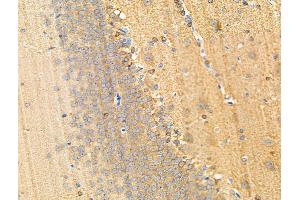 ABIN6256183 and ABIN6267191 at 1/100 staining Rat brain tissue by IHC-P. (tau Antikörper  (pSer199, pSer516))