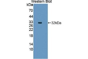 Detection of Recombinant CTNNa1, Human using Polyclonal Antibody to Catenin Alpha 1 (CTNNa1) (CTNNA1 Antikörper  (AA 2-228))