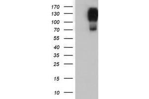 HEK293T cells were transfected with the pCMV6-ENTRY control (Left lane) or pCMV6-ENTRY ENPEP (Right lane) cDNA for 48 hrs and lysed. (ENPEP Antikörper)