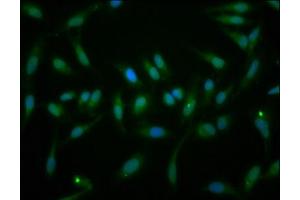 Immunofluorescence staining of Hela cells with ABIN7152355 at 1:166, counter-stained with DAPI. (EYA1 Antikörper  (AA 168-321))