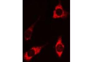 ABIN6269202 staining HEK 293 cells by IF/ICC.