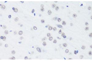 Immunohistochemistry of paraffin-embedded Rat brain using TriMethyl-Histone H3-K64 Polyclonal Antibody at dilution of 1:100 (40x lens). (Histone 3 Antikörper  (3meLys64))