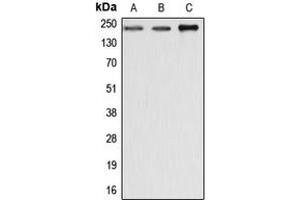 Western blot analysis of Dysferlin expression in MCF7 (A), SP2/0 (B), rat liver (C) whole cell lysates.