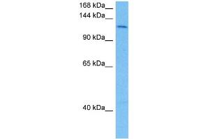 Host:  Mouse  Target Name:  SMC3  Sample Tissue:  Mouse Liver  Antibody Dilution:  1ug/ml (SMC3 Antikörper  (N-Term))
