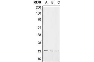 Western blot analysis of SNX3 expression in A2058 (A), Raw264. (Sorting Nexin 3 Antikörper  (Center))