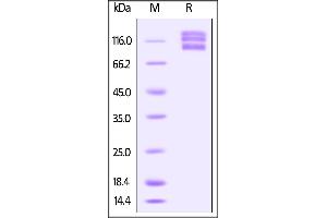 Human ITGAV & ITGB5 Heterodimer Protein on SDS-PAGE under reducing (R) condition.
