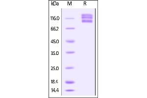 Human ITGAV & ITGB5 Heterodimer Protein on SDS-PAGE under reducing (R) condition. (ITGAV/ITGB5 Protein (AA 31-992) (His tag))