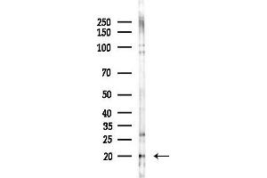 Western blot analysis of lysates from LoVo cells(heat-shock,45 min treatment), using DNAJC24 Antibody at 1/1000 dilution.
