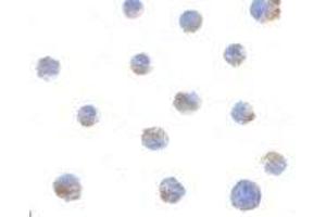 Immunocytochemistry of BIK in Jurkat cells with AP30150PU-N BIK antibody at 1 μg/ml. (BIK Antikörper  (N-Term))