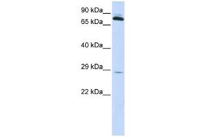 TPK1 antibody used at 1 ug/ml to detect target protein.