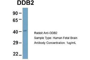 Host: Rabbit  Target Name: DDB2  Sample Tissue: Human Fetal Brain  Antibody Dilution: 1. (DDB2 Antikörper  (C-Term))