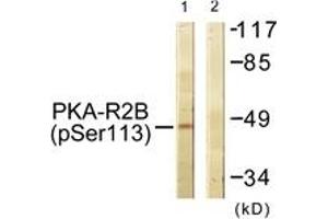 Western blot analysis of extracts from COS7 cells treated with PMA 125ng/ml 30', using PKA-R2 beta (Phospho-Ser113) Antibody.
