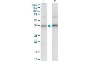 Western Blot analysis of TSPAN32 expression in transfected 293T cell line by TSPAN32 monoclonal antibody (M02), clone 2B4.