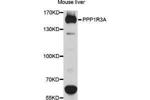 Western blot analysis of extracts of mouse liver cells, using PPP1R3A antibody. (PPP1R3A Antikörper)