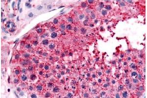 Human Testis (formalin-fixed, paraffin-embedded) stained with UCHL3 antibody ABIN213583 at 10 ug/ml followed by biotinylated goat anti-rabbit IgG secondary antibody ABIN481713, alkaline phosphatase-streptavidin and chromogen. (UCHL3 Antikörper  (Internal Region))