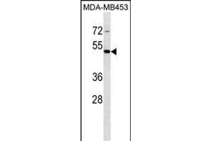 STAC Antibody (C-term) (ABIN1537013 and ABIN2849881) western blot analysis in MDA-M cell line lysates (35 μg/lane).