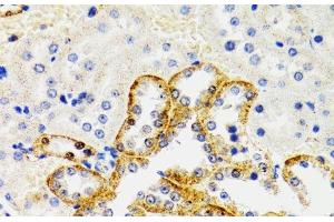 Immunohistochemistry of paraffin-embedded Rat kidney using SH2B1 Polyclonal Antibody at dilution of 1:100 (40x lens). (SH2B1 Antikörper)