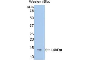 Western blot analysis of the recombinant protein. (Melatonin Receptor 1A Antikörper  (AA 216-257))