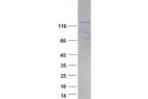 Western Blotting (WB) image for Nuclear Factor of Activated T-Cells, Cytoplasmic, Calcineurin-Dependent 4 (NFATC4) (Transcript Variant 1) protein (Myc-DYKDDDDK Tag) (ABIN2727216)