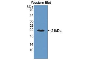 Figure. (ALDH2 Antikörper  (AA 59-150))