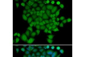 Immunofluorescence analysis of U2OS cells using NEDD9 Polyclonal Antibody (NEDD9 Antikörper)