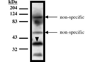 Western Blotting (WB) image for anti-HIR Histone Cell Cycle Regulation Defective Homolog A (HIRA) (AA 1-200), (N-Term) antibody (ABIN264454) (HIRA Antikörper  (N-Term))