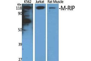 Western Blot (WB) analysis of specific cells using M-RIP Polyclonal Antibody.