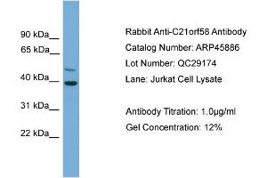 WB Suggested Anti-C21orf58  Antibody Titration: 0. (C21orf58 Antikörper  (N-Term))