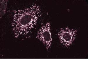 Immunofluoresence staining of NIH-3T3 cells. (Cortactin Antikörper)