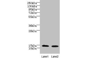 Western blot All lanes: FAM136A antibody at 8 μg/mL Lane 1: Hela whole cell lysate Lane 2: Caco-2 whole cell lysate Secondary Goat polyclonal to rabbit IgG at 1/10000 dilution Predicted band size: 16 kDa Observed band size: 16 kDa (FAM136A Antikörper  (AA 2-138))