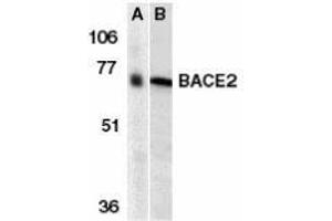 Western blot analysis of BACE2 in human (A) and mouse (B) heart tissue lysates with AP30112PU-N BACE2 antibody at 1 μg/ml. (BACE2 Antikörper  (N-Term))