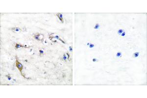 Peptide - +Immunohistochemical analysis of paraffin-embedded human brain tissue using JM4 antibody (#C0238). (PRAF2 Antikörper)