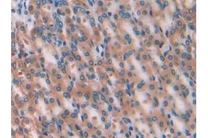 IHC-P analysis of Rat Stomach Tissue, with DAB staining.