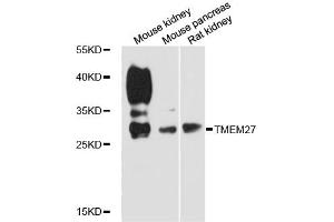 Western blot analysis of extracts of various cell lines, using TMEM27 antibody (ABIN6292811) at 1:3000 dilution. (TMEM27 Antikörper)