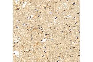 IHC analysis of SEMA4F using anti-SEMA4F antibody (ABIN7601432).