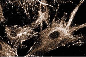 Immunofluoresence staining of human fibroblasts. (Paxillin Antikörper  (AA 1-557))